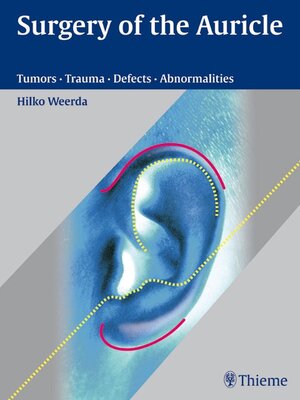 cover image of Surgery of the Auricle